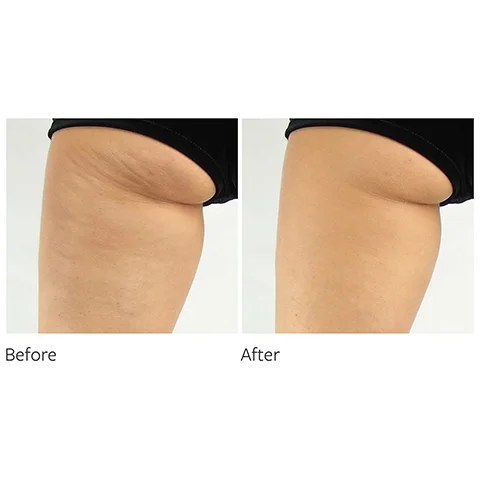 before and after