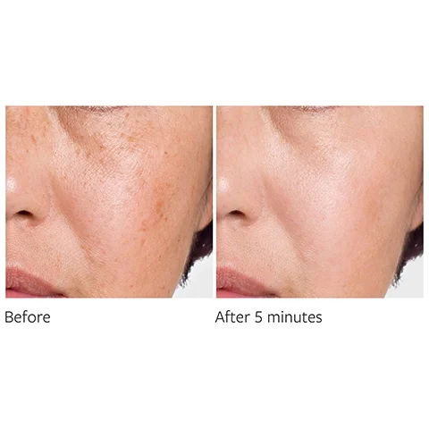before and after