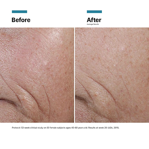 Image 1 - Image showing a side-by-side comparison of skin before and after treatment, with the left side labeled Before displaying visible wrinkles and the right side labeled After showing smoother skin, along with text at the bottom detailing a 52-week clinical study on 50 female subjects ages 40-60 years old, with results at week 20.
Image 2 - Image of a dropper filled with yellow liquid next to a petri dish containing drops of the same liquid, accompanied by text highlighting key ingredients: 15% PURE VITAMIN C (L-ascorbic acid), 1% VITAMIN E (Alpha tocopherol), and 0.5% FERULIC ACID.
Image 3 - Image shows a dropper bottle of SkinCeuticals C E Ferulic serum with glossy liquid drops and visible text stating PROVEN RESULTS, Increases firmness, Reduction in the appearance of fine lines, and Reduction in the appearance of wrinkles.
Image 4 - Image of a fast-absorbing serum depicted in a fluid, glossy texture, accompanied by text stating Texture Fast-absorbing serum Skin Type Normal Dry Combination.
Image 5 - A professional woman with long, dark hair is smiling and wearing a black blazer, alongside a text box that includes the title PHYSICIAN INSIGHT and a quote about a products antioxidant benefits attributed to Dr. Ana Mansouri from Dr Ana The Skin Clinic.
Image 6 - Image comparing three antioxidant serums, including C E Ferulic, Silymarin CF™, and Phloretin CF, along with their concerns, skin types, and benefits: C E Ferulic addresses wrinkles and loss of firmness for normal, dry, or combination skin with anti-aging benefits; Silymarin CF™ targets blemishes and oily skin for combination and oily types with oil and blemish control benefits; Phloretin CF focuses on fine lines, discoloration, and uneven skin tone for normal, combination, or oily skin, promoting an even skin tone.
Image 7 - A close-up image shows a hand holding a dropper dispensing facial oil onto another hand, accompanied by instructions for application: Step 1 - In the morning after cleansing, dispense 4-5 drops into clean hands; Step 2 - Gently press into skin on the face, neck, and décolleté.
Image 8 - Image showing four skincare products arranged in a row with headers for each step: Step 1 Prevent, C E Ferulic; Step 2 Correct, H.A. Intensifier Multi-Glycan; Step 3 Correct, A.G.E. Interruptor Advanced; Step 4 Protect, Advanced Brightening UV Defense Sunscreen SPF 50.
Image 9 - Image showing a comparison chart titled A.M. / P.M. Antioxidant Comparison featuring two skincare products: C E Ferulic on the left with a dropper bottle, and Resveratrol B E on the right in a pump bottle; the chart includes concerns, skin types, and benefits for both products.