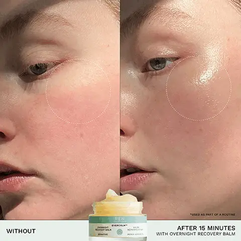 Image 1, *USED AS PART OF A ROUTINE WITHOUT REN EVERAL AFTER 15 MINUTES WITH OVERNIGHT RECOVERY BALM Image 2, REN OVERNIGHT RECOVERY BALM EVERCALMTM BALM REPART SOSITIVE PERUS CLINICALLY PROVEN TO REPAIR THE SKIN BARRIER AFTER 15 MINUTES* *CLINICAL STUDY ON SO VOLUNTEERS Image 3, ✓ REPAIRS ✓ REPLENISHES CALMS MICROBIOME-FRIENDLY SAFE FOR SENSITIVE & ECZEMA-PRONE SKIN FAMILY SAFE Image 4, BIOACTIVES → ENZYMATICALLY ACTIVATED OILS help repair and strengthen the skin barrier JOJOBA & SUNFLOWER OIL COMPLEX reinforces the skin barrier, minimizing TEWL → BETA-GLUCAN soothes skin and alleviates visible signs of sensitivity Image 5, OVERNIGHT RECOVERY BALM SENSITIVE REN CLEAN SKINCARE EVERCALMTM BAUME RÉPARATEUR NUT PEAUX SENSIBLES RECYCLABLE GLASS JAR Image 6, STEP 01 CLEANSE STEP 02 HYDRATE REN CLENNUK LATE SUS STEP 03 TARGET STEP 04 REPAIR REN REN REN GENTLE CLEANSING MILK ULTRA COMFORTING REDNESS RELIEF RESCUE MASK SERUM OVERNIGHT RECOVERY BALM