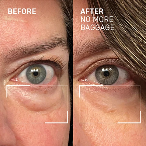 image 1 and 2, before and after no more baggage. image 3 and 4, before and after one use of no more baggage. image 5, 97% showed an improvement in the appearance of under eye bags and puffiness after 5 minutes. self assessment test conducted on 30 volunteers. image 6, no sleep? no problem. reduces the look of bags under eyes. restores the look of elasticity. brightens under eye area. image 7, synthetic fragrance free. sulfate free. paraben free. cruelty free. image 8, step 1 = cleanse, step 2 = exfoliate, step 3 = treat, step 4 = moisturise, step 5 = prime. how: after your eye moisturiser, warm a tiny amount between fingers and gently pat directly on bags and dark circles. use alone of under makeup. for best results let dry in between applications. when = daily in the morning.