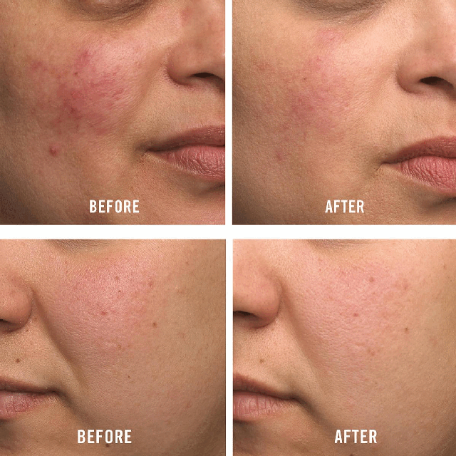 Images 1-2 Before and After
