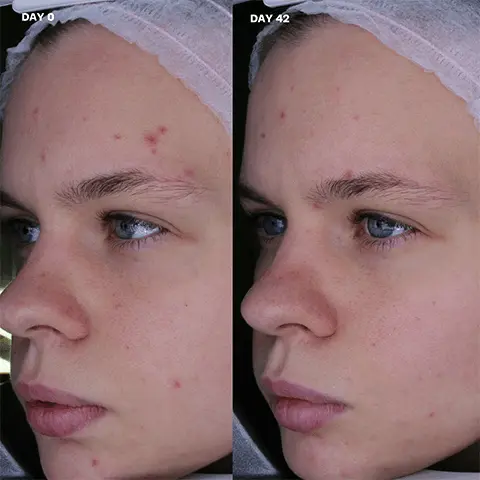 Image 1, Day 0 to Day 42 results. Image 2, Women and home Beauty Awards Winner 2022 Badge