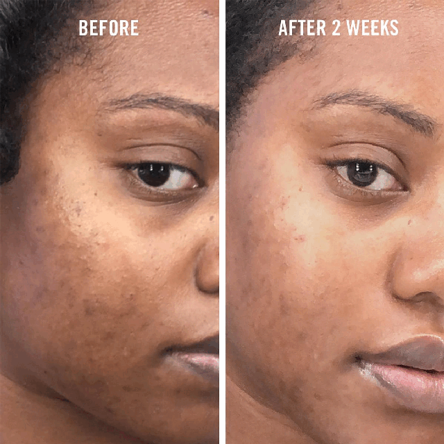 Image 1-2 before and after