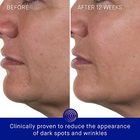 Image 3 - A side-by-side comparison shows a persons profile before and after 12 weeks; the left side displays visible wrinkles and dark spots, while the right side has smoother skin. Clinically proven to reduce the appearance of dark spots and wrinkles is written in the lower part of the image.
Image 4 - A blue and gold bottle of Augustinus Bader skincare product is shown against a light background, with text indicating that skin hydration is improved by 2.4 times, skin firmness and elasticity are improved by 36%, and forehead wrinkles are visibly reduced by 37%, along with a note about a 4-week clinical trial.
Image 5 - A blue bottle of Augustinus Bader skincare cream is shown on a copper-colored background, with text indicating user proven results: 100% agree skin feels instantly hydrated and nourished, 100% agree complexion looks plump and replenished, and 95% agree the appearance of fine lines/wrinkles is dramatically improved; additional text notes the results are based on a 12-week Consumer Perception Study of 107 participants.
Image 6 - A bottle of Augustinus Baders The Rich Cream is shown against a blue background, with text noting TFC8® for skin cellular renewal, evening primrose oil for elasticity and texture, argan oil for moisture barrier repair, and hyaluronic acid for hydration.
Image 7 - Image showing two skincare products side by side: on the left, The Cream by Augustinus Bader with a lightweight daily moisturizer description, key benefits of hydrating and revitalizing, key concerns including dryness and fine lines for combination to oily skin; on the right, The Rich Cream by Augustinus Bader with a rich daily moisturizer description, key benefits of nourishing and renewing, key concerns including dryness and wrinkles for normal to dry skin.
Image 8 - An image titled The Routine that displays a skincare regimen with four steps, featuring blue and orange product containers labeled as Cleanse, Correct & Hydrate, Nourish & Renew, and Perfect & Revitalize, along with descriptions of the products used in each step.
Image 9 - Four skincare products from Augustinus Bader in blue bottles with gold accents, displayed in descending order of size, labeled as 100 ml, 50 ml, 30 ml, and 15 ml, with visible text reading THE RICH CREAM WITH TFC8 and LA CRÈME HYDRATANTE RICHE AVEC TFC8.