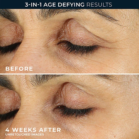Image 1 - A split image shows a close-up of an eye area before and after treatment, with the top half showing more prominent wrinkles and the bottom half, labeled 4 WEEKS AFTER UNRETOUCHED IMAGES, showing visibly smoother skin around the eye, above text that reads 3-IN-1 AGE DEFYING RESULTS and BEFORE. Image 2 - A white and gold tube of RoC Retinol Correxion eye cream stands prominently, flanked by text detailing product benefits and an Allure beauty award seal, VISIBLY REDUCES EYE WRINKLES BY 50% 90% SAW VISIBLY REDUCED DARK CIRCLES 84% SAW PUFFINESS IMPROVED CLINICALLY PROVEN RoC CLINICALLY PROVEN RETINOL CORREXION® LINE SMOOTHING EYE CREAM + ADVANCED RETINOL 0.5 FL. OZ. (15 ML) BEST OF BEAUTY allure THE BEAUTY EXPERT AWARD WINNER 2022. Image 3 - A close-up of skin with a drop of white product from an applicator and a black and white portrait of a smiling man includes the text BOARD-CERTIFIED DERMATOLOGIST DR. MAXFIELD and SIMPLICITY AT ITS FINEST, TIME-RELEASED RETINOL IS PERFECTLY BALANCED GIVING DRAMATIC RESULTS WITHOUT THE IRRITATION. Image 4 - A golden liquid with many large and small bubbles, advertising RoC® RETINOL VISIBLY SMOOTHS, BRIGHTENS & DEPUFFS. Image 5 - A close-up of a persons eye with three dots of white cream on the skin below and a finger near the outer corner, with overlay text that says Target 3 Visible Signs of Aging Reduces Lines, Dark Circles & Depuffs. Image 6 - A before and after comparison image of a persons neck, showing the neck with wrinkles on the left before treatment and a smoother, firmer appearance on the right after 4 weeks, with text that reads VISIBLY LIFT & FIRM NECK, BEFORE, and 4 WEEKS AFTER UNRETOUCHED IMAGES.