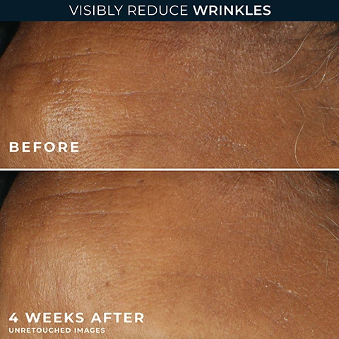 Image 1 - A before and after comparison image of skin showing wrinkles, with the top portion labeled BEFORE displaying prominent wrinkles, and the bottom portion labeled 4 WEEKS AFTER displaying reduced wrinkles, all under the main heading VISIBLY REDUCE WRINKLES with a note reading UNRETOUCHED IMAGES. Image 2 - The image shows a close-up of skin with a drop of cream and a black and white photo of a smiling woman, alongside the text Board-Certified Dermatologist Dr. Nina Desai and 2 Key Ingredients, Retinol + SPF, In 1 Powerhouse Moisturizer.