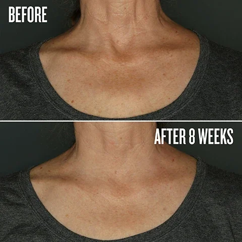 before and after 8 weeks