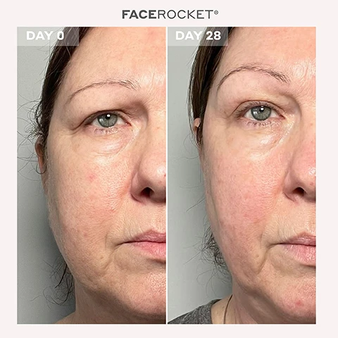 Image 1 - Image shows a side-by-side comparison of a womans face labeled DAY 0 on the left and DAY 28 on the right, highlighting changes in her skin appearance over 28 days.
Image 2 - Side-by-side comparison of a womans face showing results after 28 days of using the FACE ROCKET product, with the left image labeled DAY 0 and the right image labeled DAY 28.
Image 3 - Image shows a side-by-side comparison of a womans face labeled DAY 0 on the left and DAY 28 on the right, with visible differences in skin clarity and appearance.
Image 4 - A side-by-side comparison of a womans profile on the left labeled DAY 0, showing her face with visible redness, and on the right labeled DAY 28, displaying a smoother appearance with less redness.
Image 5 - A person holding a gray handheld device with a red light at the top and buttons labeled FIRM, TONE, and COOL, with text alongside detailing skin care benefits like stimulate collagen production and improve lymphatic drainage.
Image 6 - A smiling woman with gray hair holds a facial beauty device in her right hand, with text nearby stating that in a survey of 32 women using the Magnitone FaceRocket with Superconductive Gel for 14 days, 94% agreed they were satisfied with the lifting and tightening effect on their facial skin, 88% agreed they were satisfied with the effect of tightening fine lines around the eyes, and 94% agreed they were satisfied with the immediate calming plus soothing effect on their skin.
Image 7 - A woman with blonde hair and a light shirt smiles while holding a skincare device, with text on the left listing features such as clinically shown results, five technologies, three easy to use modes, step-by-step 28-day face program, and additional product details.
Image 8 - Infographic describing various skin treatment methods with icons and text labeling each method: Radiofrequency, Microcurrent, Red + Green LED Light Therapy, Cryotherapy, and Sonic Massage, detailing their benefits for skin.
Image 9 - A person with braided hair is holding a skincare device next to their face, which has visible cream on it, with various award logos including Highly Commended, Winner, and Menopause Friendly displayed around the image, along with the text FIRM, TONE, and COOL on the device.